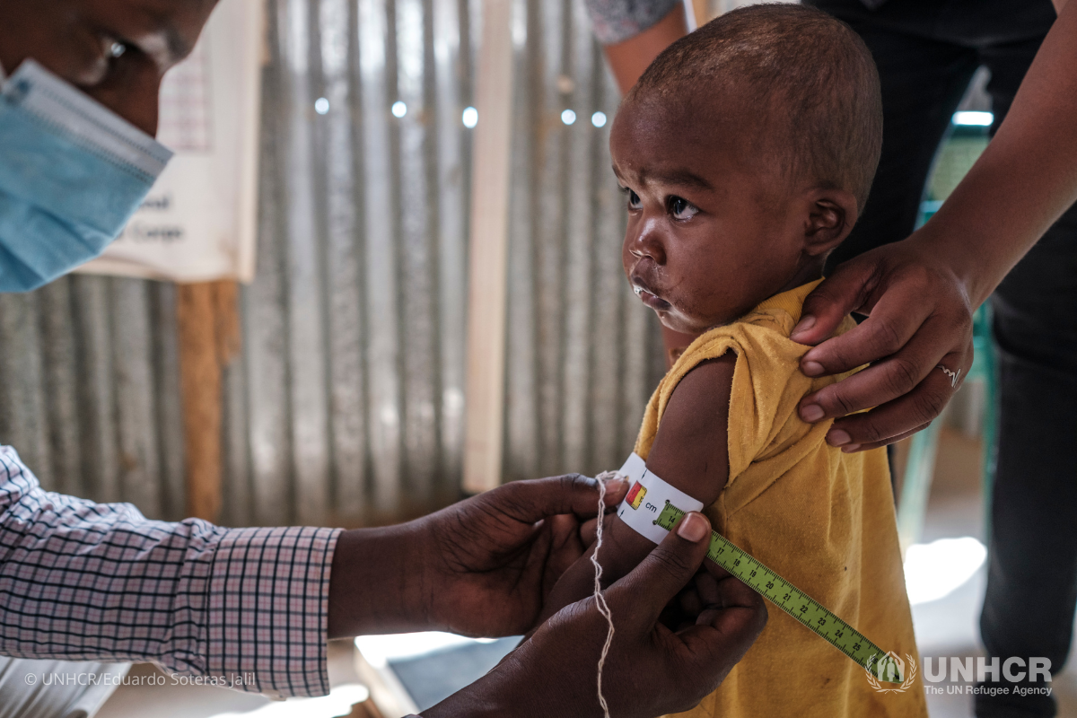 A nutrition officer measures the arm of a child in the Bokolmayo Nutrition Center, Ethiopia.