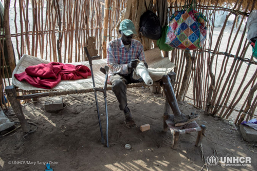 Sudanese refugee Hamoda dresses his leg before he puts on a prosthetic limb at Doro refugee camp in Upper Nile state, South Sudan.